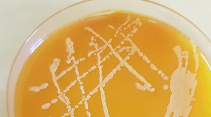 Research projects touch on phone and trolley hygiene